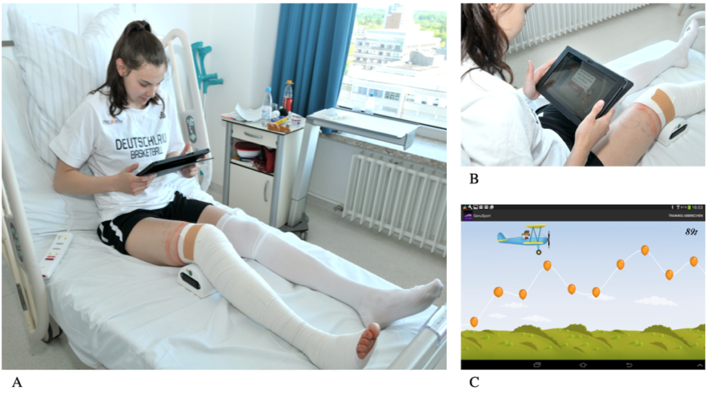 biofeedback riabilitazione LCA