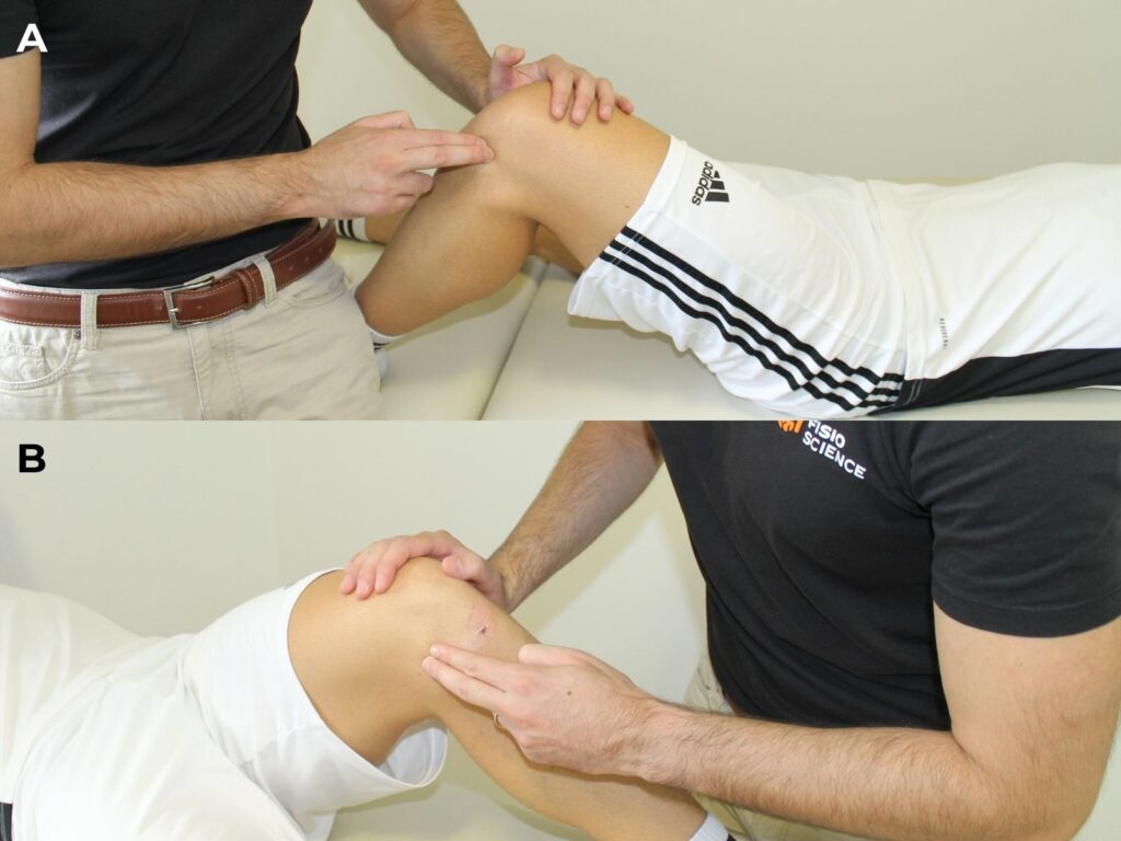 Joint Line tenderness