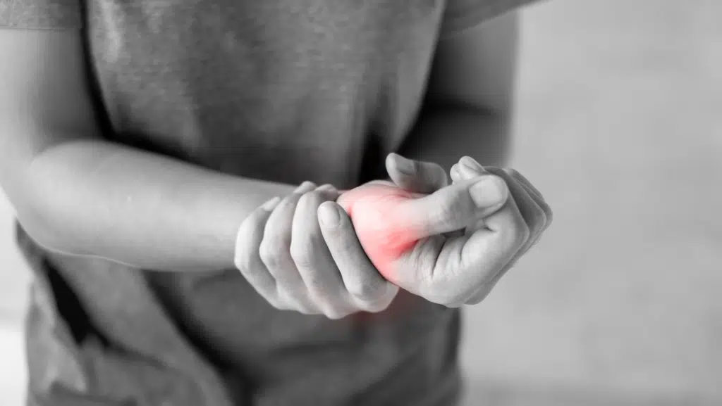 Sindrome di De Quervain: sintomi
