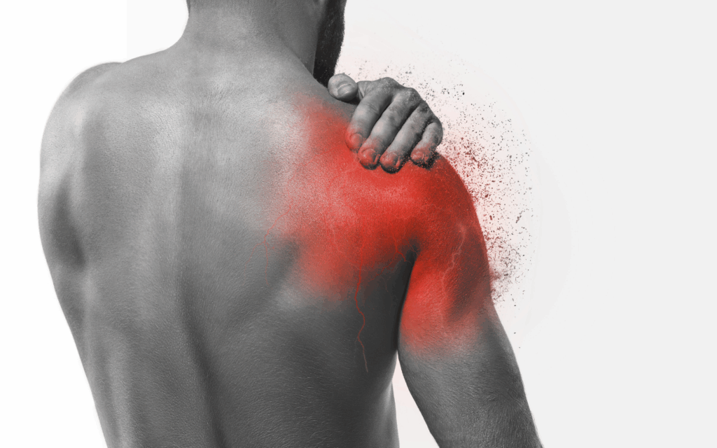 Oxford Shoulder Score