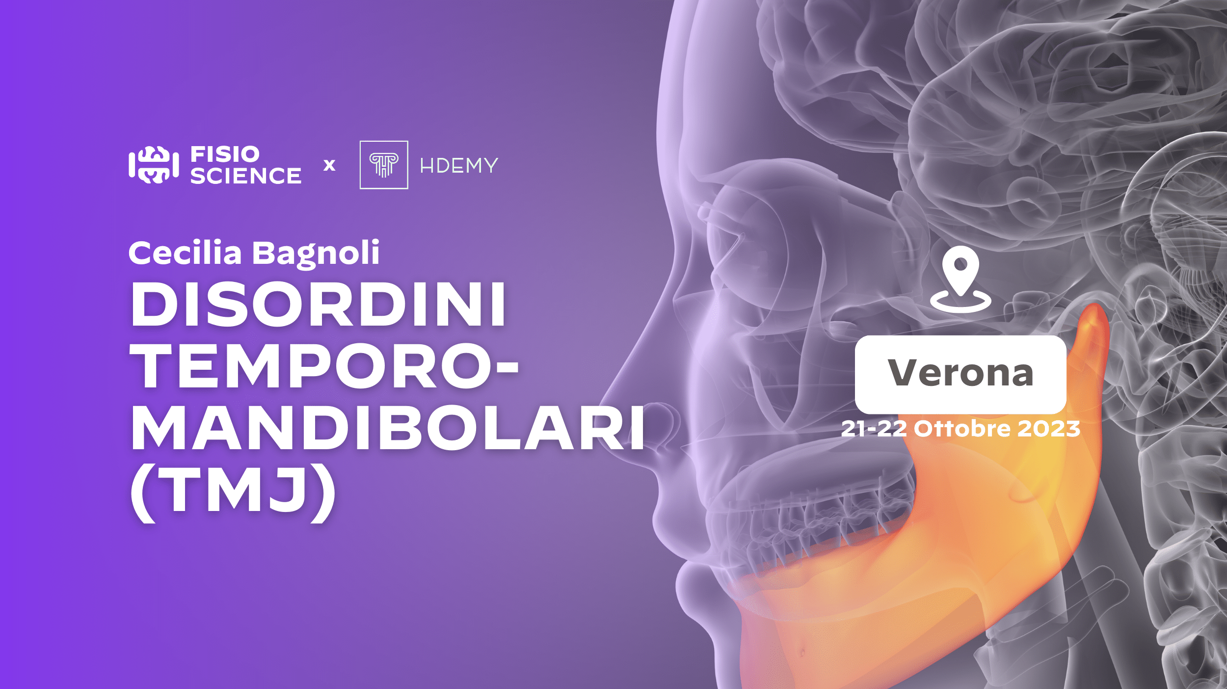 Disordini Temporo-mandibolari Cecilia Bagnoli