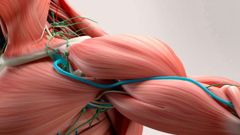 Thoracic Outlet Syndrome: quando l’entità diagnostica non è un’illusione clinica