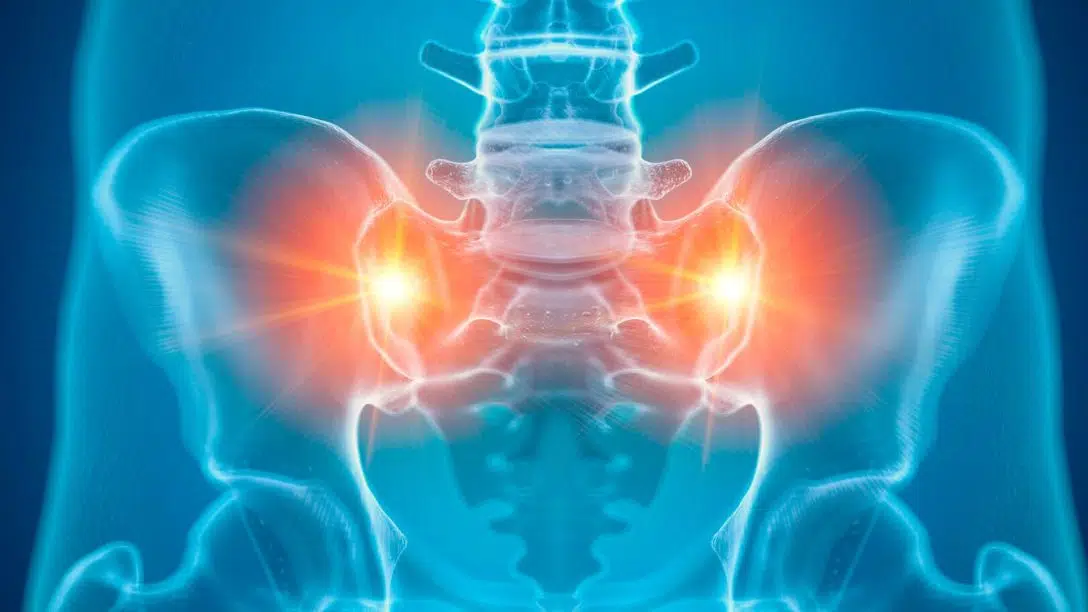 cover pelvic girdle pain