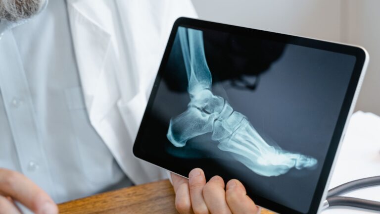 Radiologia per fisioterapisti