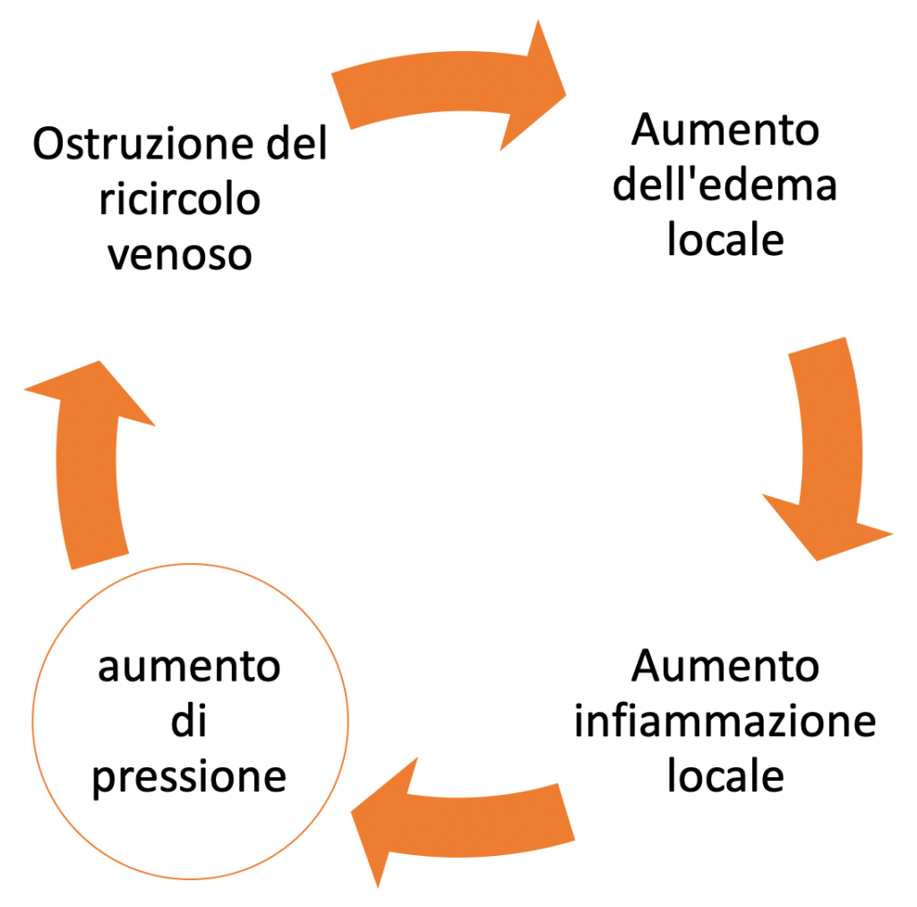 sindrome del tunnel carpale