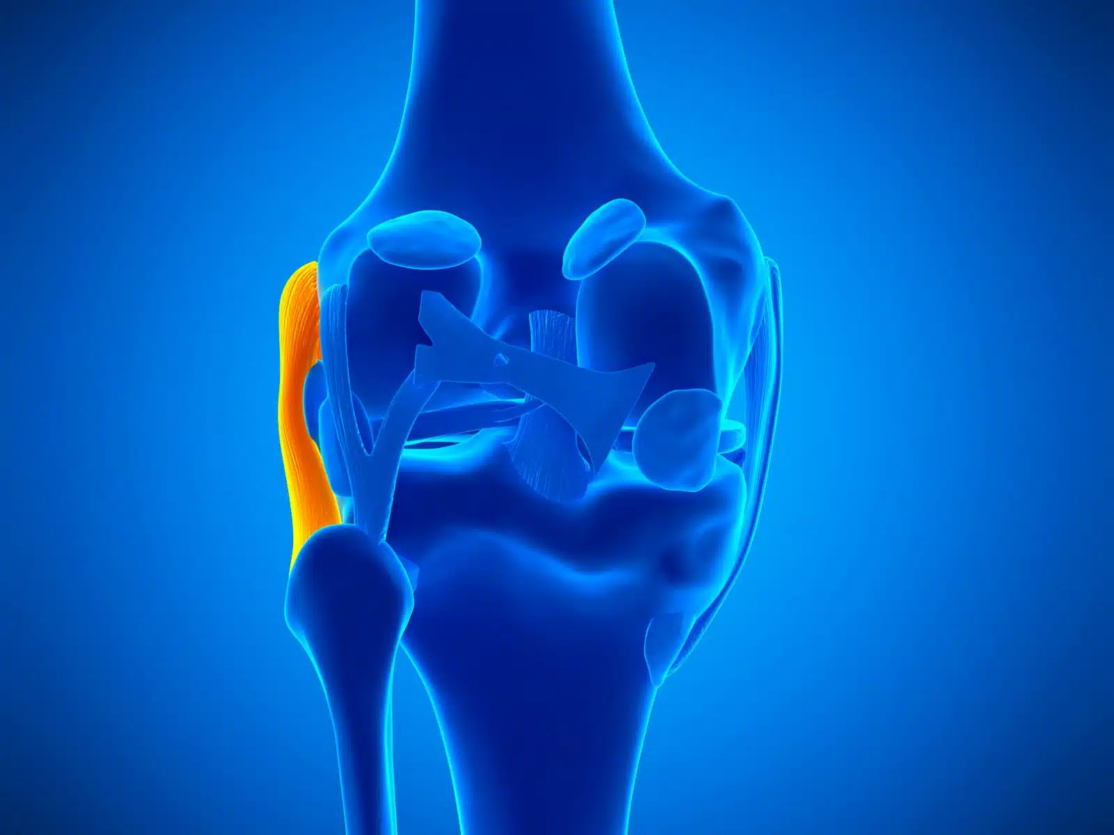 Lesione del Legamento Collaterale Laterale del ginocchio FisioScience Lesione del Legamento Collaterale Laterale del ginocchio FisioScience
