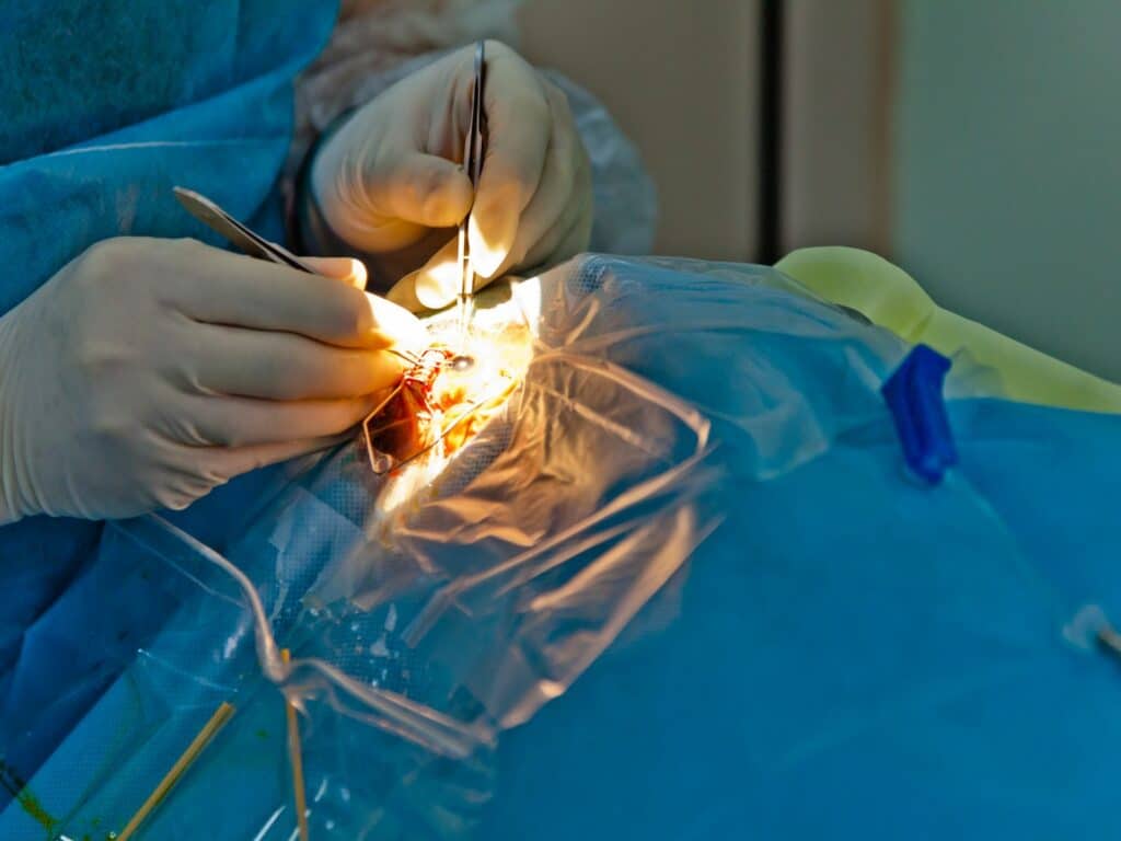 ricostruzione cuffia dei rotatori