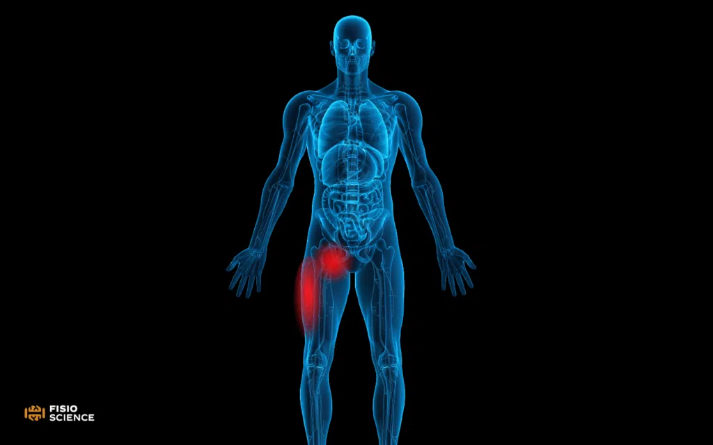 osteonecrosi della testa del femore: body chart