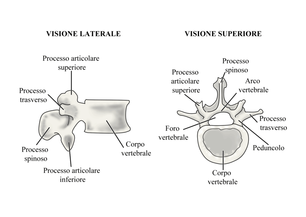 Spondilolisi: vertebra lombare