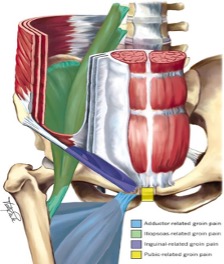 pubalgia: anatomia