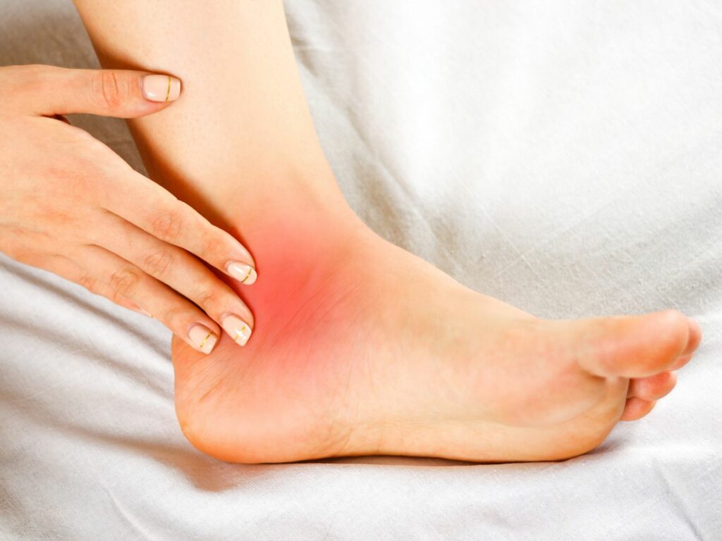 ottawa ankle rules