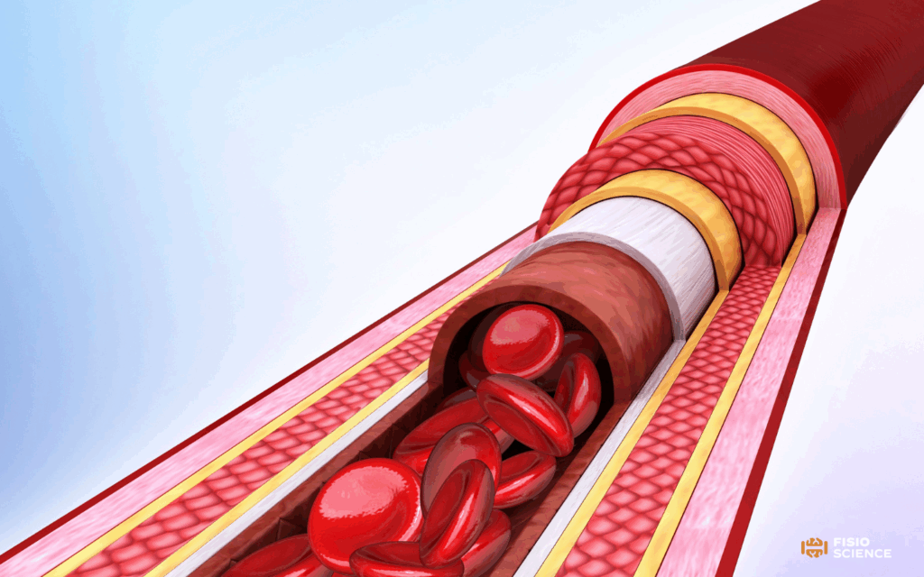 Cervical Artery Dissection CAD