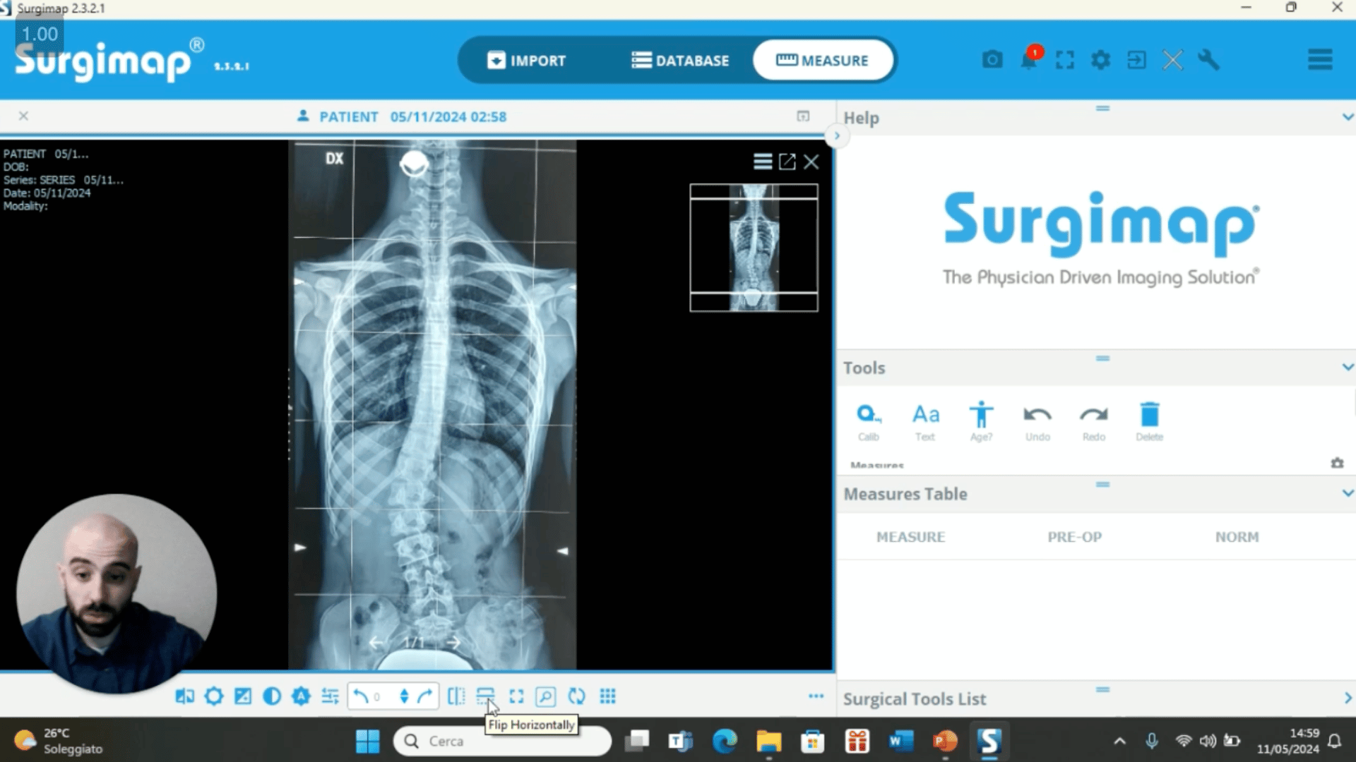 Masterclass scoliosi fisioscience Raffaele Polcaro 1