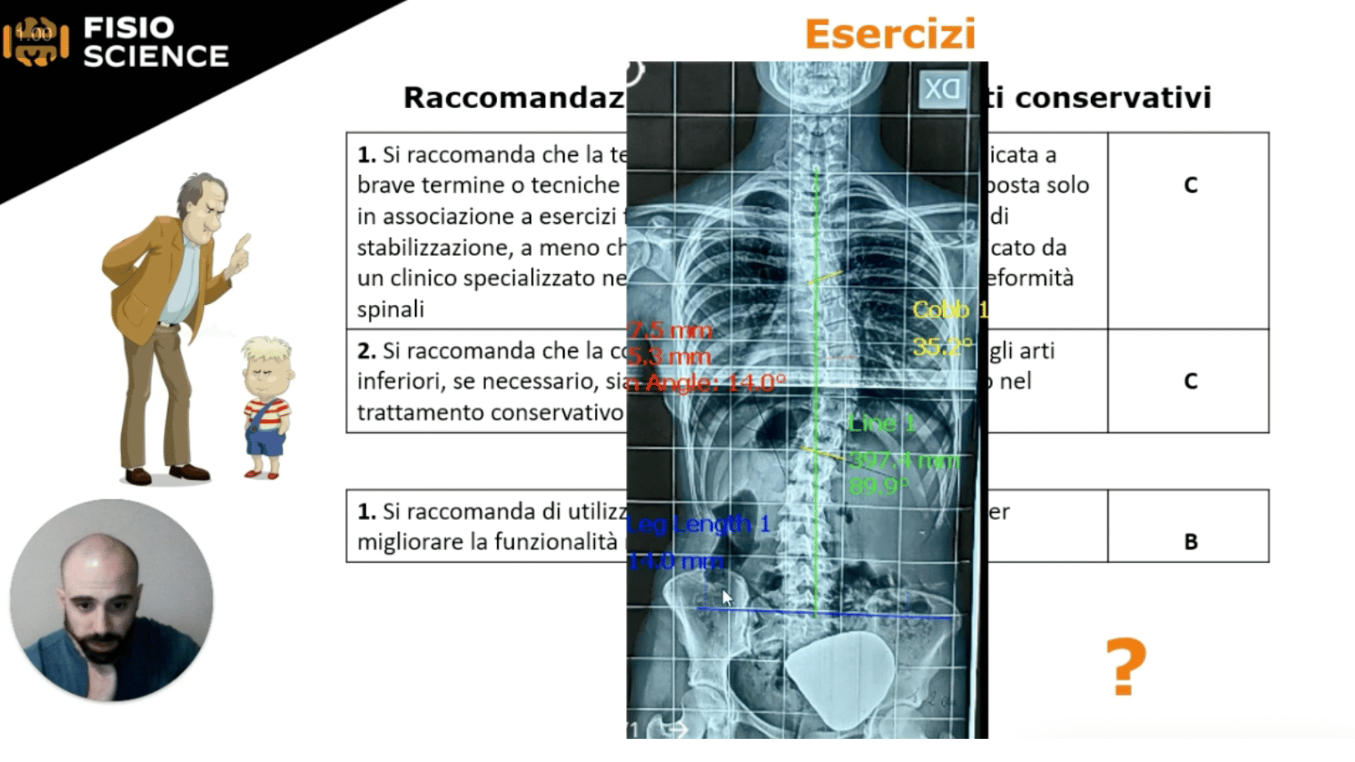 Masterclass scoliosi fisioscience Raffaele Polcaro 3