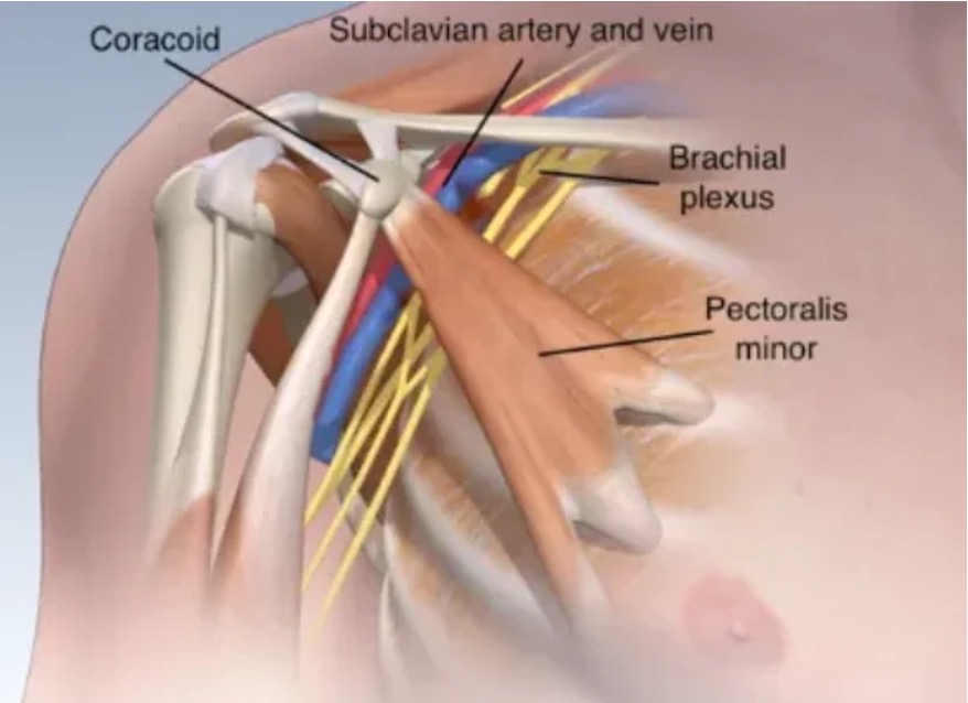 anatomia sindrome del piccolo pettorale