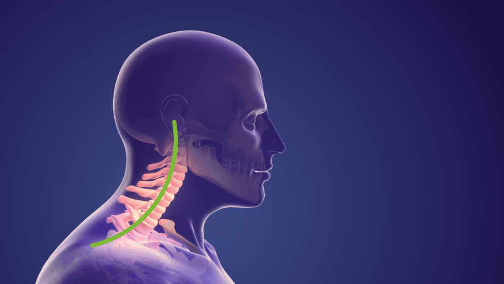Complex Regional Pain Syndrome