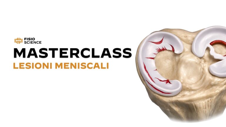 Lesioni Meniscali