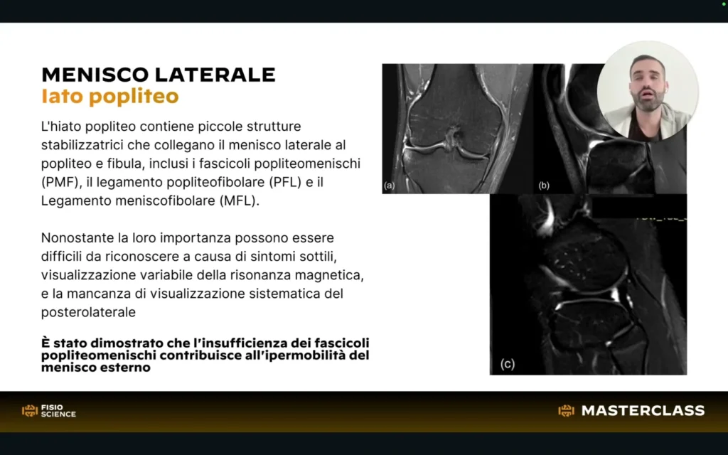 masterclass-lesioni-meniscali-lesson-04