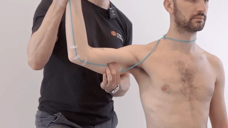 Sindromi Compressive dell’arto superiore